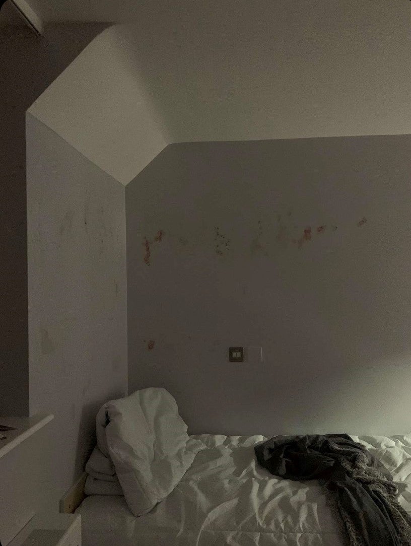 Picture of a patient’s room with blood on the walls